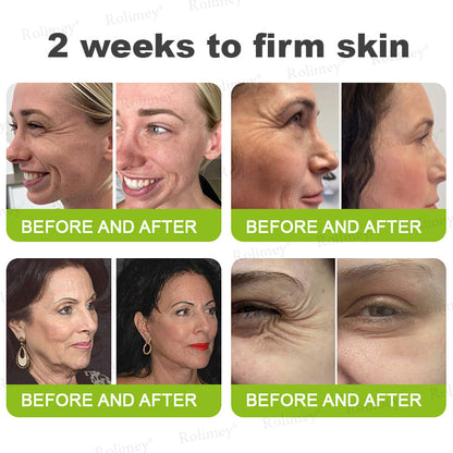 🌟👨‍⚕️Made and shipped from Australia 💫Rolimey® Botox & Vita-A Retinol Shot Wrinkle-Lift Tightening cream - Last Day Promotion 70% OFF